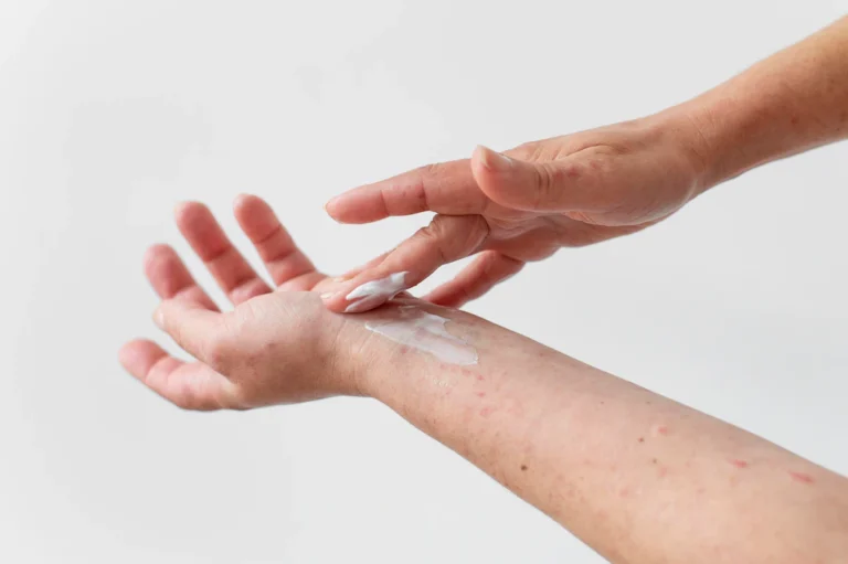 What to Use for Itchy Skin? Reliable Home Remedies!